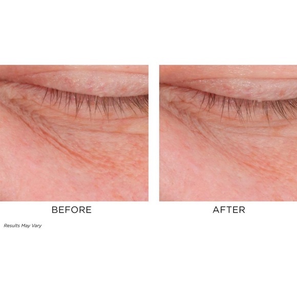 New In Box Perricone MD Cold Plasma Plus + Eye Cream Size 15 ML - Picture 4 of 15